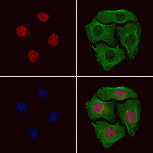 Phospho-EED (Thr55) Antibody in Immunocytochemistry (ICC/IF)