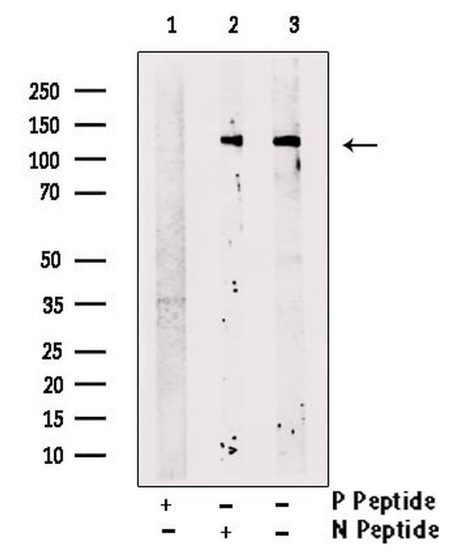 Phospho-ZEB1 (Ser887) Antibody in Western Blot (WB)