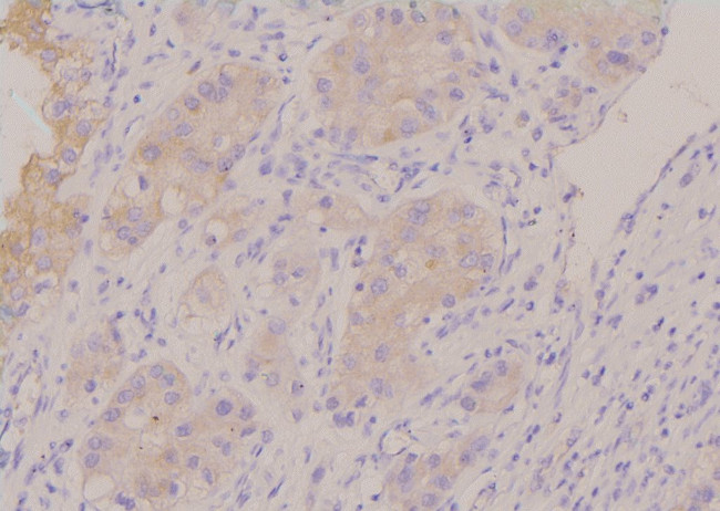 Phospho-HPRT1 (Ser110) Antibody in Immunohistochemistry (Paraffin) (IHC (P))