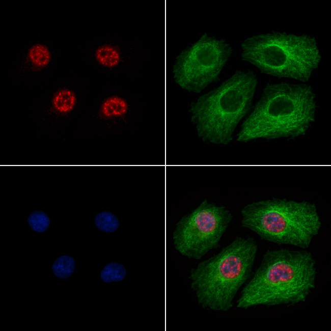 Phospho-Caspase 2 Precursor (Ser340) Antibody in Immunocytochemistry (ICC/IF)