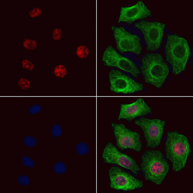 Phospho-Cullin 4B (Thr48) Antibody in Immunocytochemistry (ICC/IF)