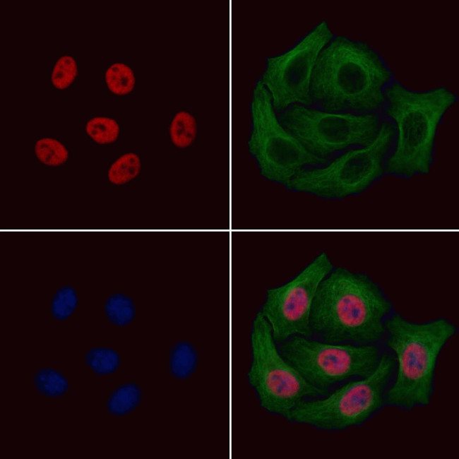 Phospho-PAX7 (Ser203) Antibody in Immunocytochemistry (ICC/IF)