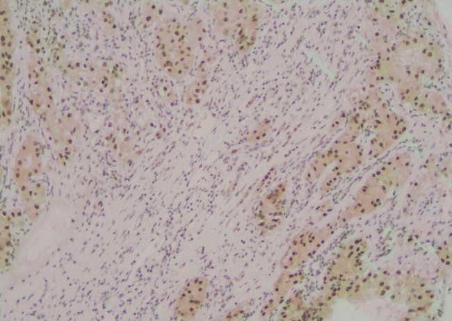 Phospho-ATG3 (Tyr18) Antibody in Immunohistochemistry (Paraffin) (IHC (P))
