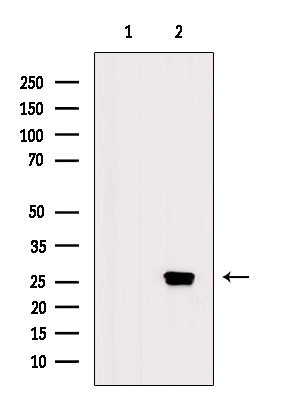 Phospho-CDC34 (Ser71) Antibody in Western Blot (WB)