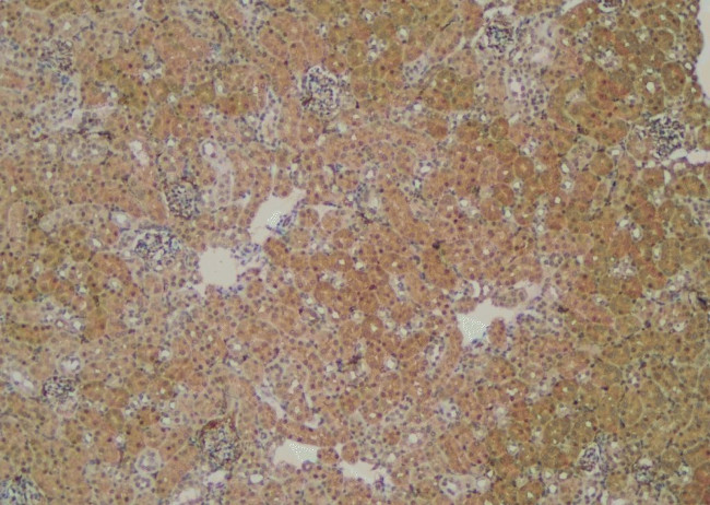 Phospho-CTNNAL1 (Tyr436) Antibody in Immunohistochemistry (Paraffin) (IHC (P))
