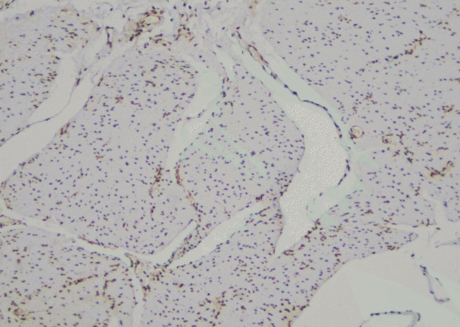 Phospho-ARHGAP42 (Tyr792) Antibody in Immunohistochemistry (Paraffin) (IHC (P))