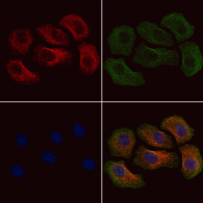 Phospho-Annexin A2 (Tyr24) Antibody in Immunocytochemistry (ICC/IF)