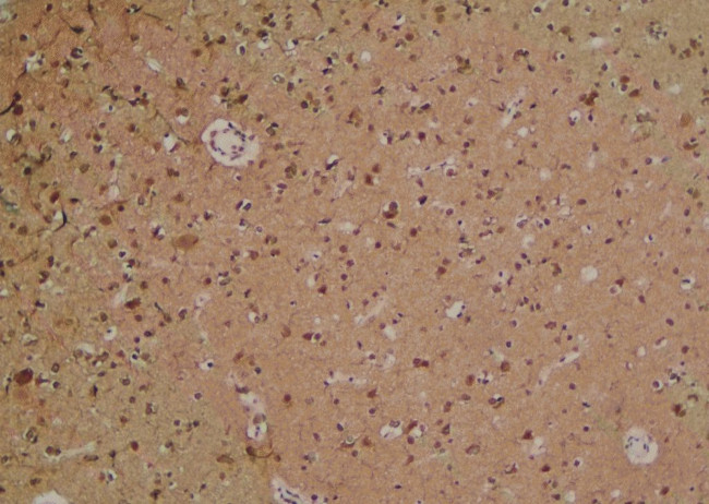 Phospho-MYPT1 (Ser299) Antibody in Immunohistochemistry (Paraffin) (IHC (P))
