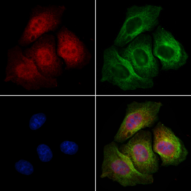 Phospho-MDMX (Ser367) Antibody in Immunocytochemistry (ICC/IF)