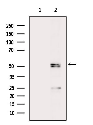 Phospho-MDMX (Ser342) Antibody in Western Blot (WB)