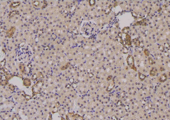Phospho-Survivin (Thr48) Antibody in Immunohistochemistry (Paraffin) (IHC (P))