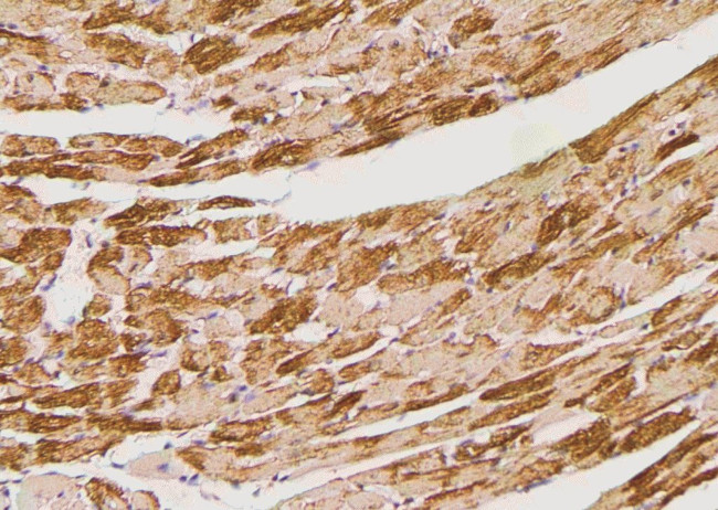 Phospho-Bim (Ser98) Antibody in Immunohistochemistry (Paraffin) (IHC (P))