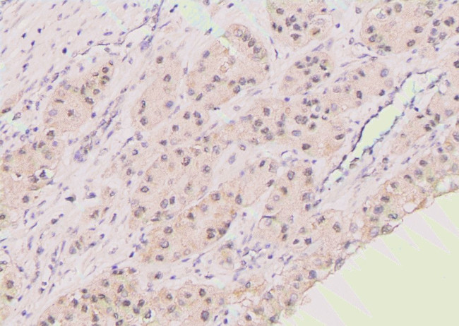 Phospho-Bim (Ser118) Antibody in Immunohistochemistry (Paraffin) (IHC (P))