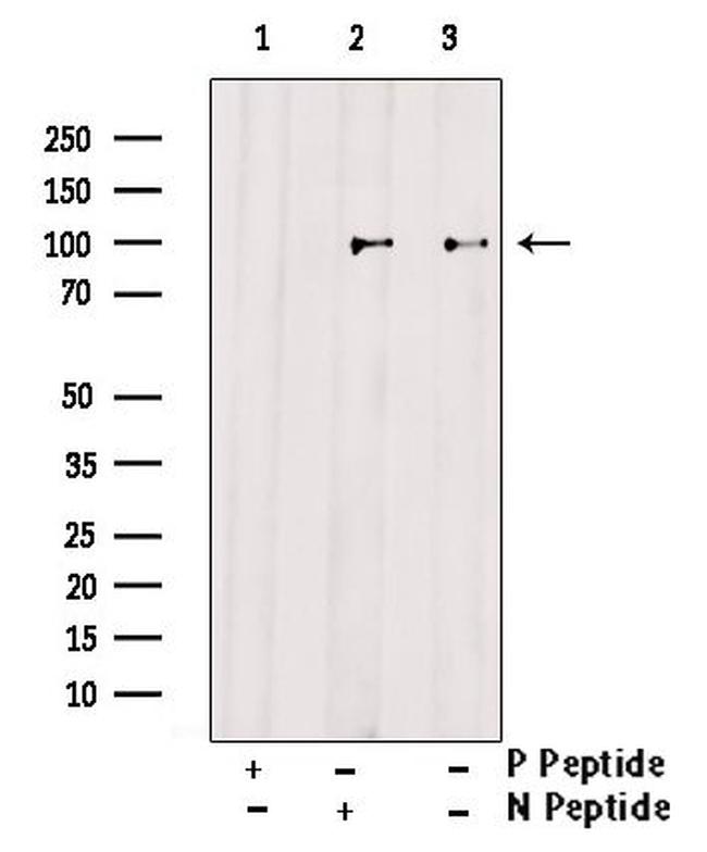 Phospho-FOXO3A (Ser555) Antibody in Western Blot (WB)