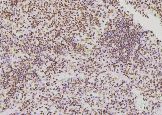 Phospho-DOK2 (Tyr402) Antibody in Immunohistochemistry (Paraffin) (IHC (P))