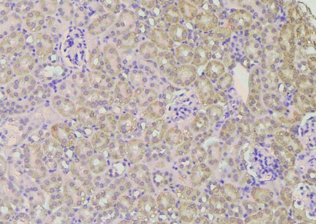 Phospho-TLR5 (Ser805) Antibody in Immunohistochemistry (Paraffin) (IHC (P))