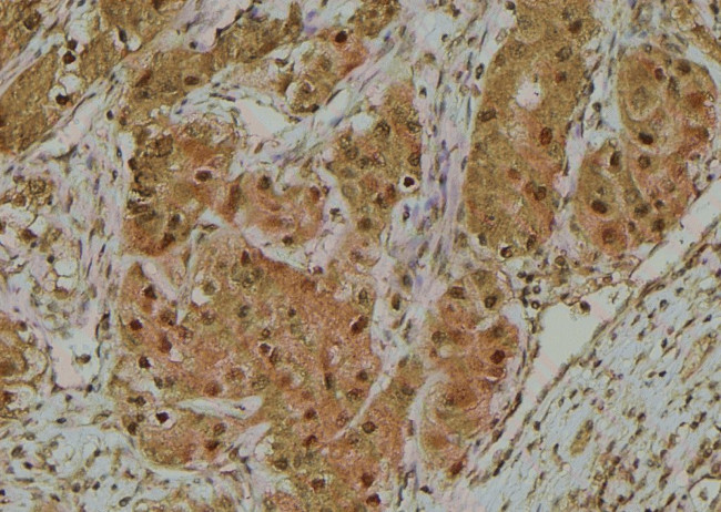 Phospho-MiTF (Ser516) Antibody in Immunohistochemistry (Paraffin) (IHC (P))
