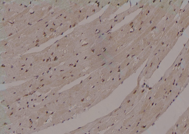 Phospho-ULK1 (Thr1046) Antibody in Immunohistochemistry (Paraffin) (IHC (P))