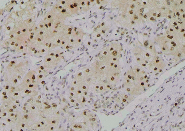 Phospho-SF3B1 (Thr211) Antibody in Immunohistochemistry (Paraffin) (IHC (P))