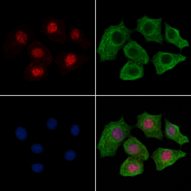Phospho-MSK2 (Ser360) Antibody in Immunocytochemistry (ICC/IF)