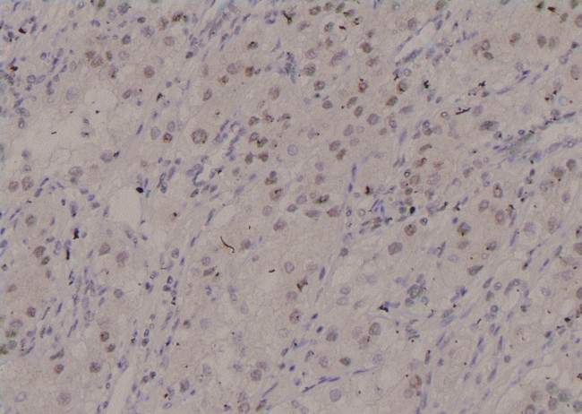 Phospho-STAM2 (Tyr371) Antibody in Immunohistochemistry (Paraffin) (IHC (P))