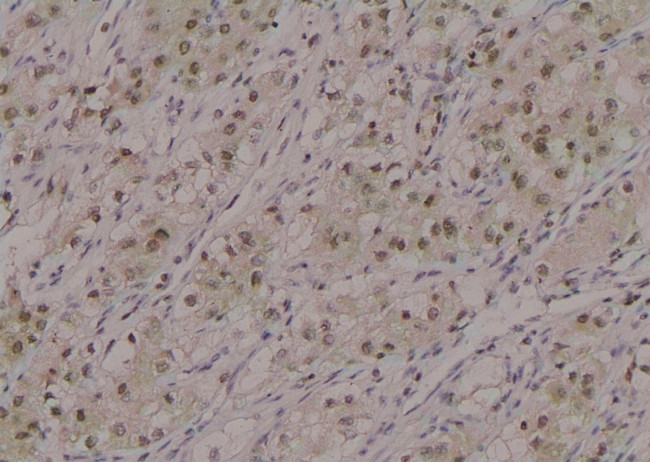 Phospho-MPZL1 (Tyr260) Antibody in Immunohistochemistry (Paraffin) (IHC (P))