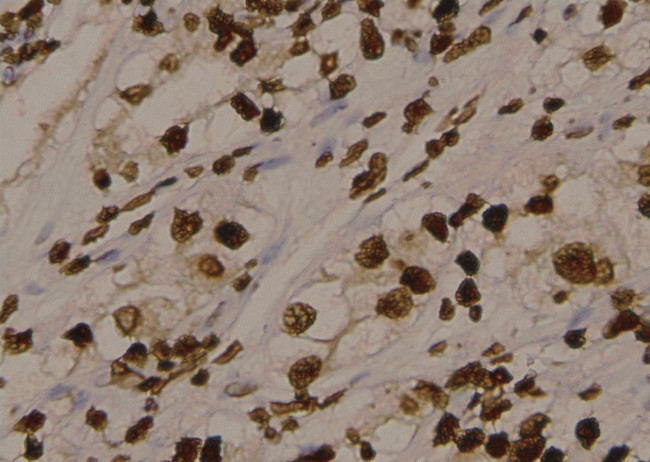 Phospho-LDHA (Tyr10) Antibody in Immunohistochemistry (Paraffin) (IHC (P))