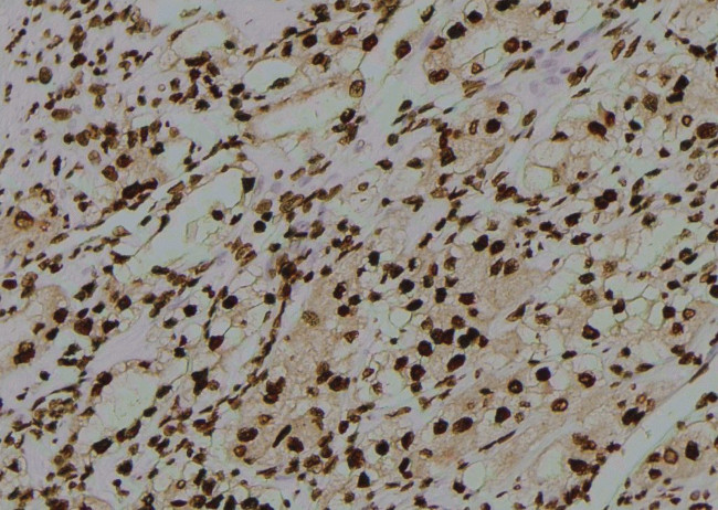 Phospho-CD25 (Ser268) Antibody in Immunohistochemistry (Paraffin) (IHC (P))
