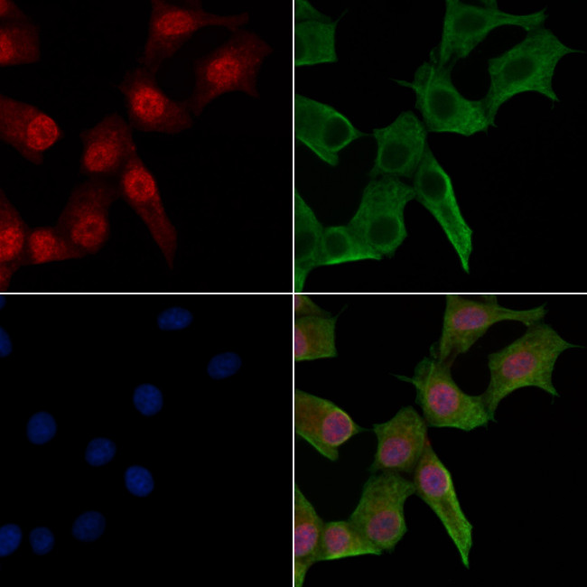 Phospho-Lamin A/C (Ser301) Antibody in Immunocytochemistry (ICC/IF)