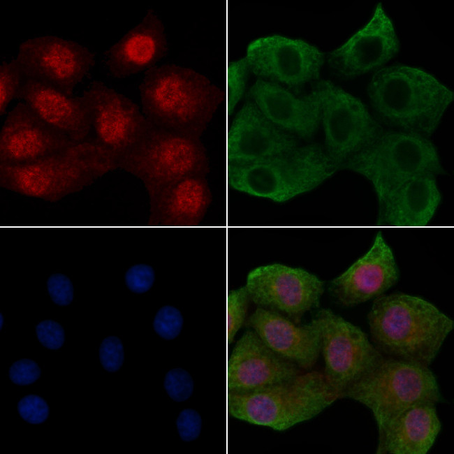 Phospho-ErbB2 (HER-2) (Tyr1005) Antibody in Immunocytochemistry (ICC/IF)