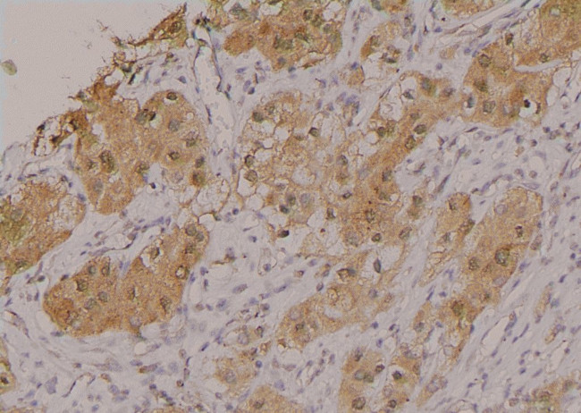 Phospho-ErbB2 (HER-2) (Ser1054) Antibody in Immunohistochemistry (Paraffin) (IHC (P))