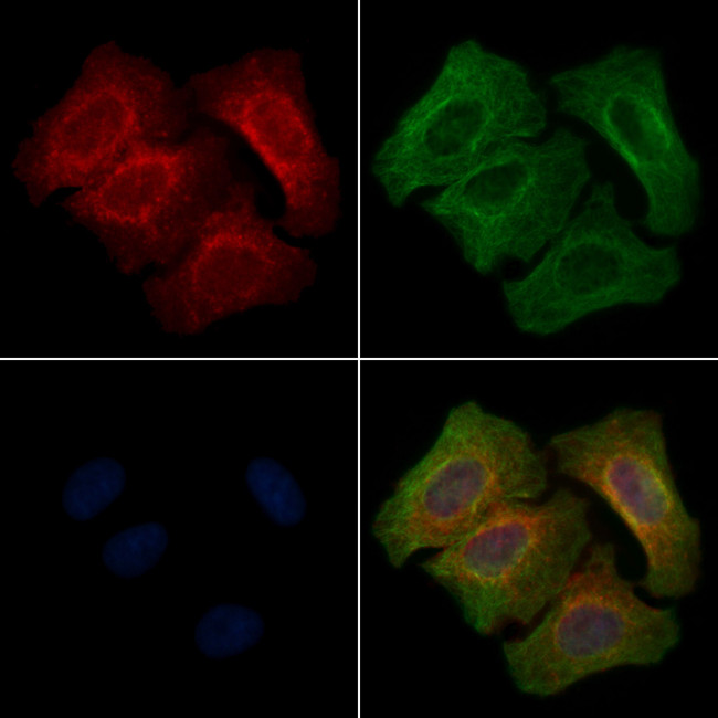Phospho-ErbB2 (HER-2) (Tyr1023) Antibody in Immunocytochemistry (ICC/IF)