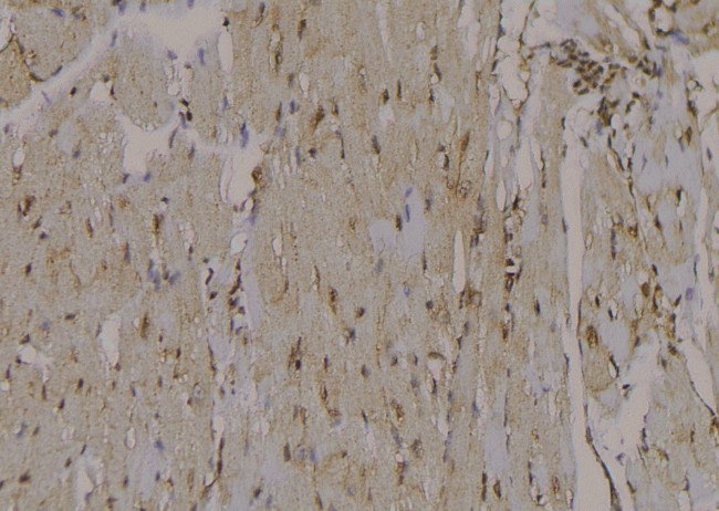 Phospho-ITGB1 (Tyr795) Antibody in Immunohistochemistry (Paraffin) (IHC (P))