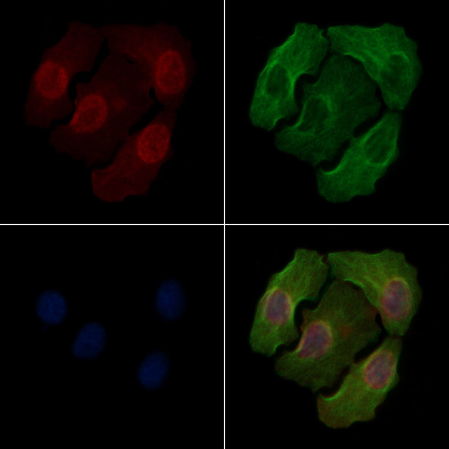 Phospho-PKC beta (Ser661) Antibody in Immunocytochemistry (ICC/IF)