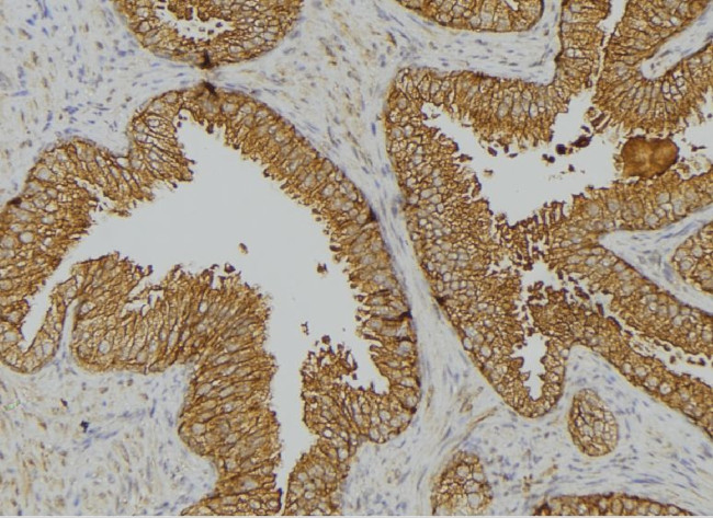 Phospho-Cytokeratin 18 (Tyr36) Antibody in Immunohistochemistry (Paraffin) (IHC (P))
