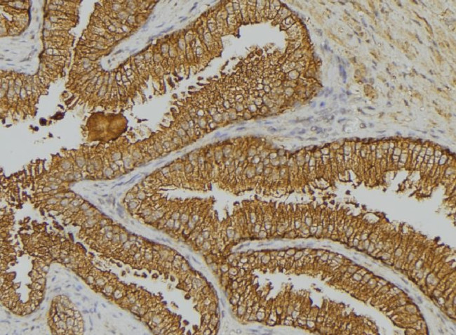 Phospho-Cytokeratin 18 (Tyr13) Antibody in Immunohistochemistry (Paraffin) (IHC (P))