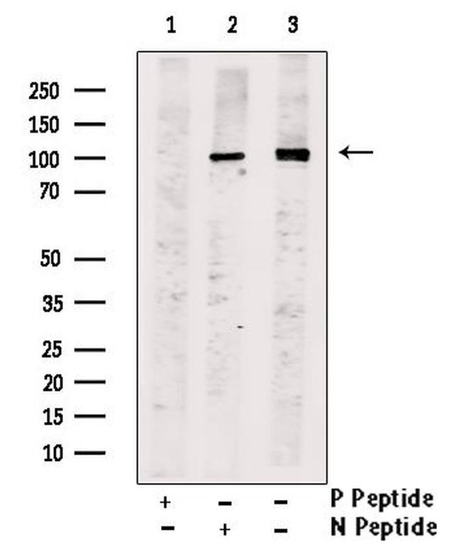 Phospho-Progesterone Receptor (Ser79, Ser81) Antibody in Western Blot (WB)