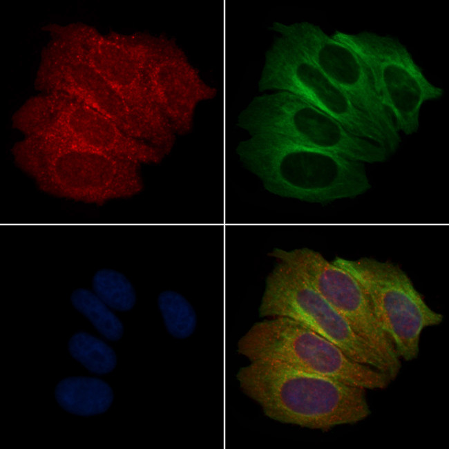Phospho-eIF4E (Thr210) Antibody in Immunocytochemistry (ICC/IF)