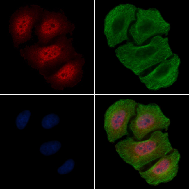 Phospho-NPM1 (Ser10) Antibody in Immunocytochemistry (ICC/IF)