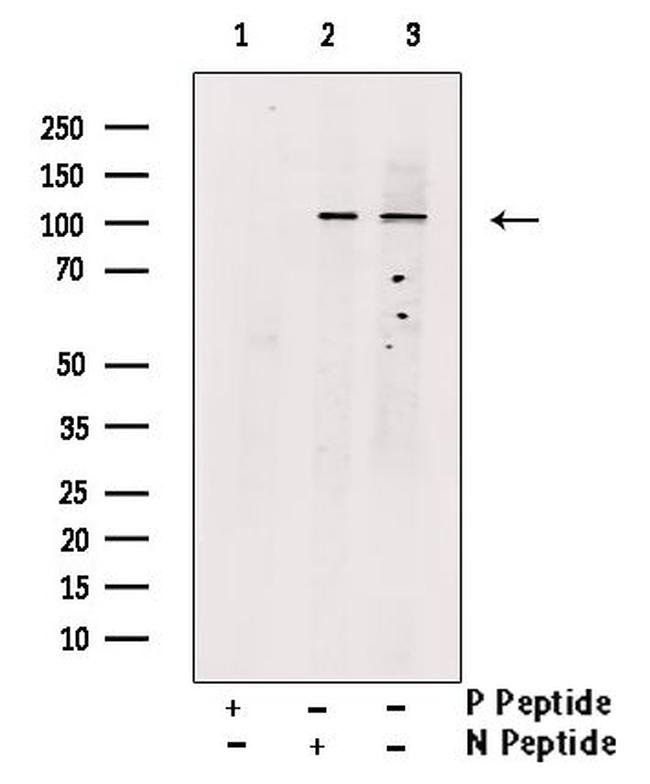 Phospho-CSF1R (Tyr546) Antibody in Western Blot (WB)