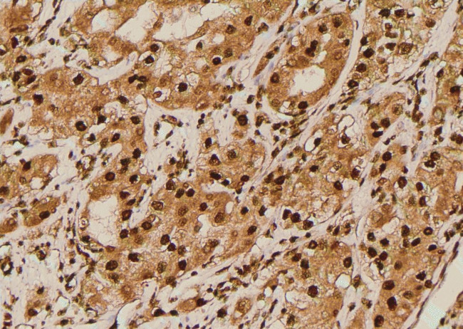 Phospho-IGF1R (CD221) (Thr1163) Antibody in Immunohistochemistry (Paraffin) (IHC (P))