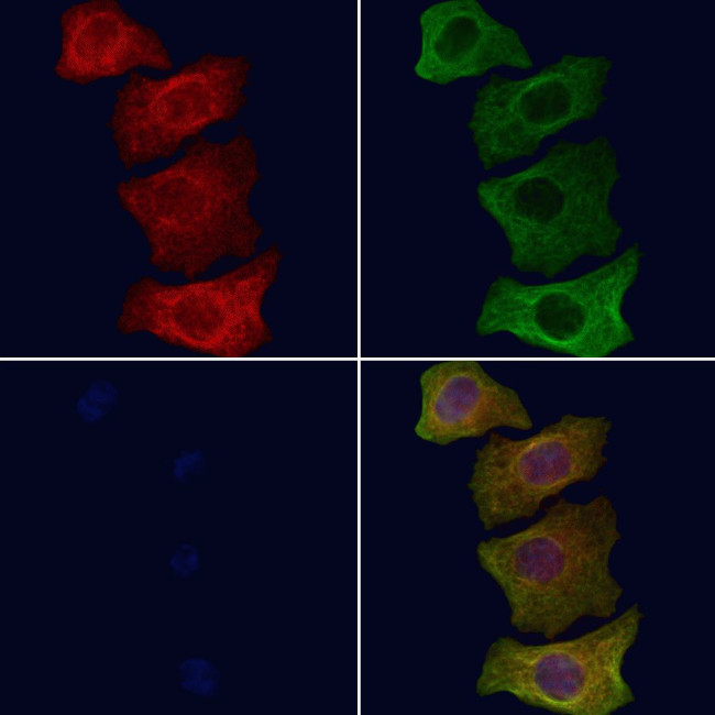 Phospho-Vimentin (Tyr117) Antibody in Immunocytochemistry (ICC/IF)