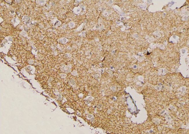 Phospho-BCR (Ser301) Antibody in Immunohistochemistry (Paraffin) (IHC (P))