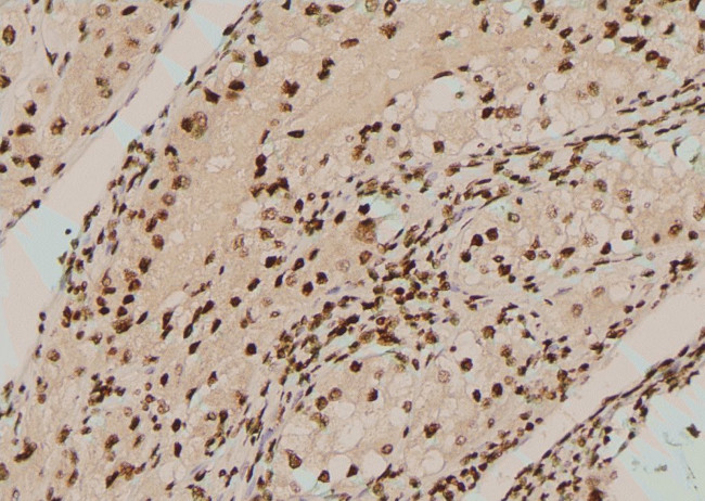 Phospho-BCR (Tyr852) Antibody in Immunohistochemistry (Paraffin) (IHC (P))