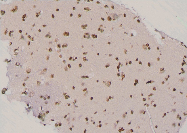 Phospho-CD79a (Tyr199) Antibody in Immunohistochemistry (Paraffin) (IHC (P))