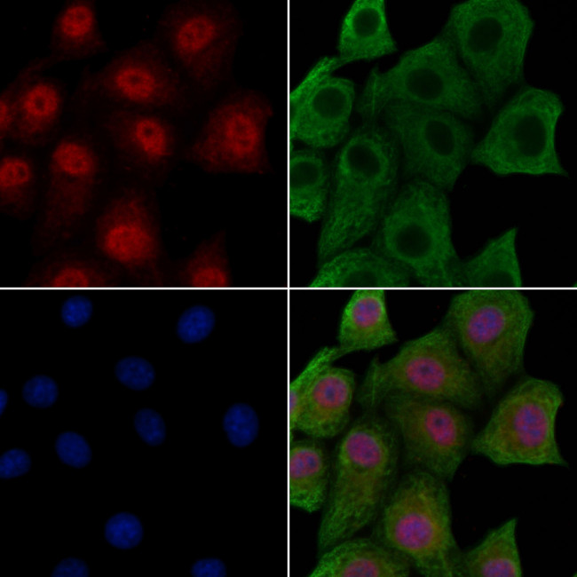 Phospho-EEF2 (Tyr443) Antibody in Immunocytochemistry (ICC/IF)