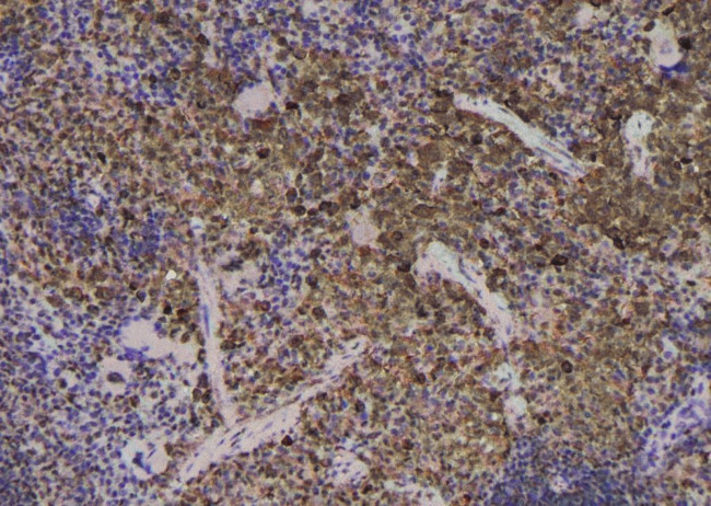 Phospho-EEF2 (Thr57) Antibody in Immunohistochemistry (Paraffin) (IHC (P))