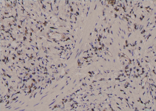 Phospho-PKM2 (Tyr83) Antibody in Immunohistochemistry (Paraffin) (IHC (P))
