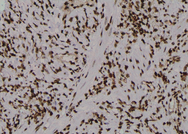 Phospho-PKM2 (Tyr148) Antibody in Immunohistochemistry (Paraffin) (IHC (P))