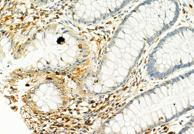 Phospho-PKM2 (Ser37) Antibody in Immunohistochemistry (Paraffin) (IHC (P))